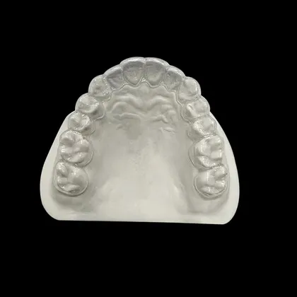 Näkymättömät oikomishoidot